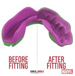 Safe Jawz Chránič zubů Marvel The Hulk