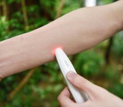 Sorbo Upokojujúce termo pero Itch Healer